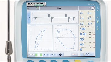 fabian HFO: Waves and loops