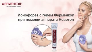 Ионофорез с гелем Ферменкол при помощи аппарата Невотон