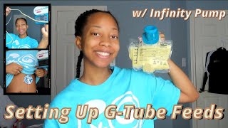 How I Setup My Feeding Tube Nutrition ➰