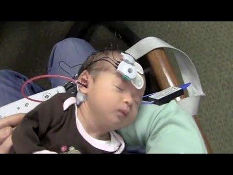 Newborn Hearing Testing Screening (OAE and ABR)