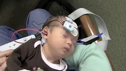 Newborn Hearing Testing Screening (OAE and ABR)