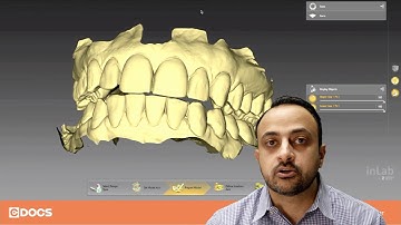 Tip of the Day: Splint with Leaf Gauge