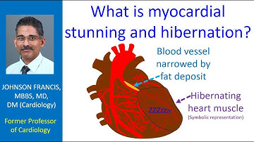 What is myocardial stunning and hibernation?