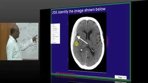NEETPG Image based MCQ Mock Test Discussion 1624 Lec 04 Download uMedico App