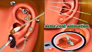 Relaxing Pus Removal from Piercing ASMR | Gentle Ear Infection Treatment ASMR | Piercing cleaning