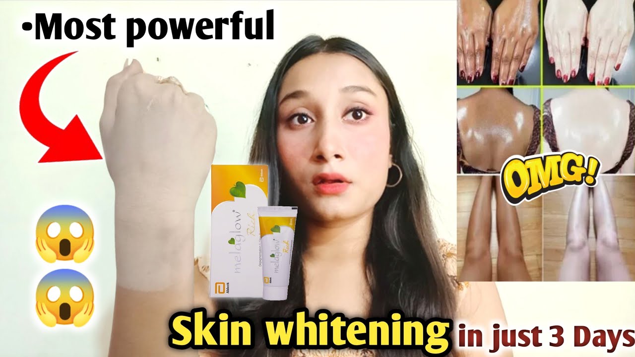 Melaglow rich creambest skin whitening creammelaglow creamskin