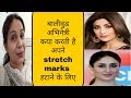 Bollywood actress कया करती हैं अपने  stretch marks गायब करने के लिए