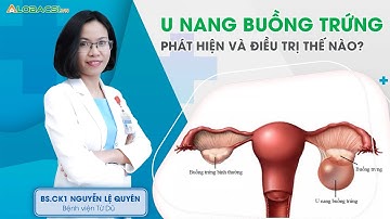 U nang buồng trứng phát hiện và điều trị thế nào? | BS.CK1 Nguyễn Lệ Quyên