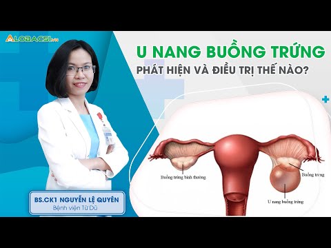 Video: Các cách đơn giản để thu nhỏ u nang buồng trứng: 9 bước (có hình ảnh)