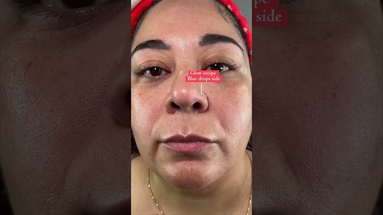 TRUE TEST of these pore blurring drops on someone with Significant pores!! 