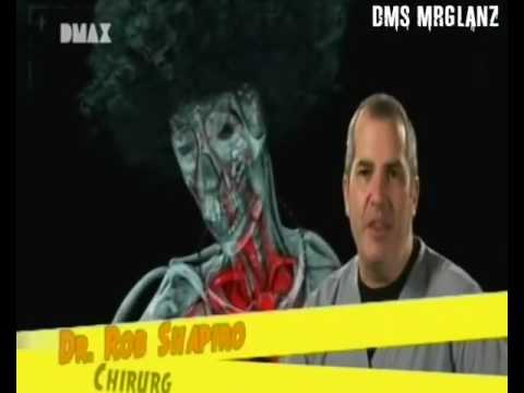 1000 Wege Ins Gras Zu Beißen Stream