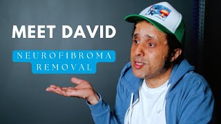 Neurofibromatosis Relief: How Electrodesiccation Improved My Confidence & Comfort