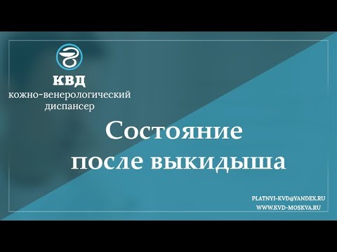 752  Состояние после выкидыша