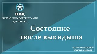 752  Состояние после выкидыша