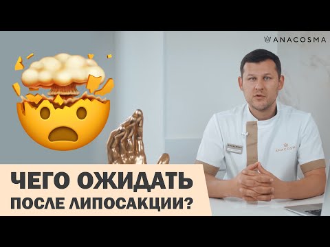 РЕАБИЛИТАЦИЯ ПОСЛЕ ЛИПОСАКЦИИ: К ЧЕМУ ГОТОВИТЬСЯ⁉️🔥