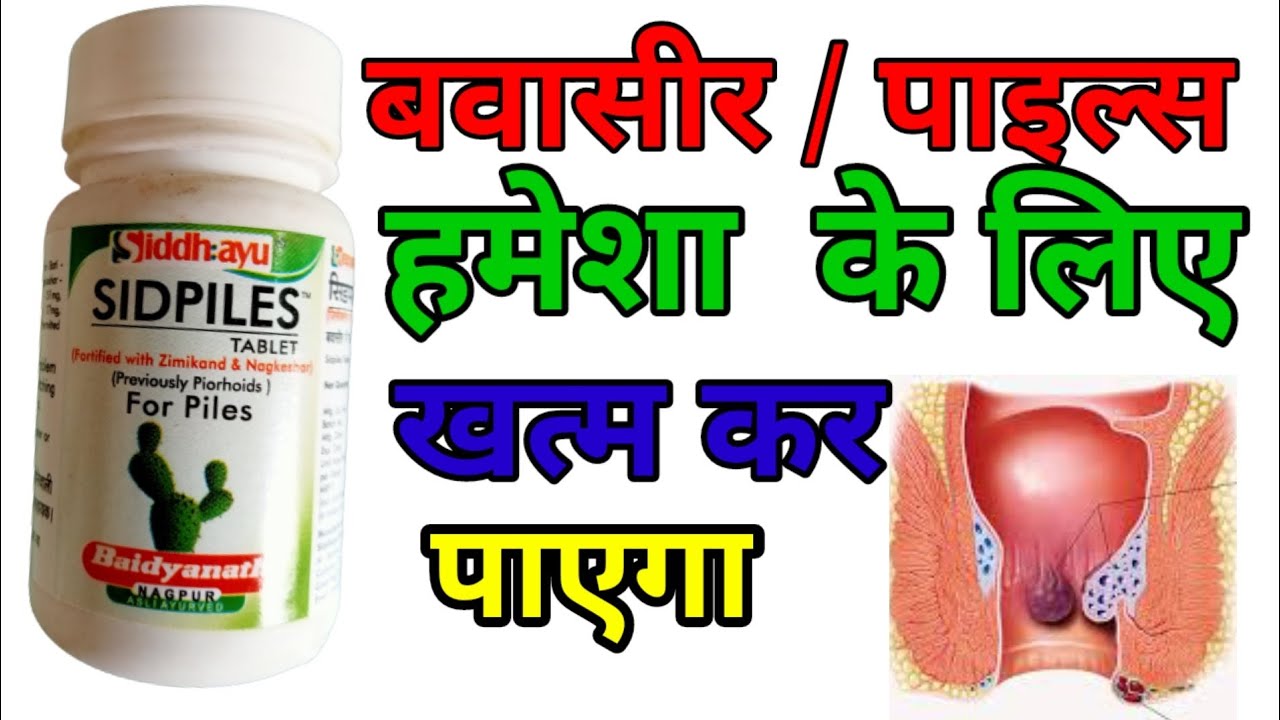 बवासीर यानी Piles को जड़ से खत्म करने का इलाज Piles treatment without