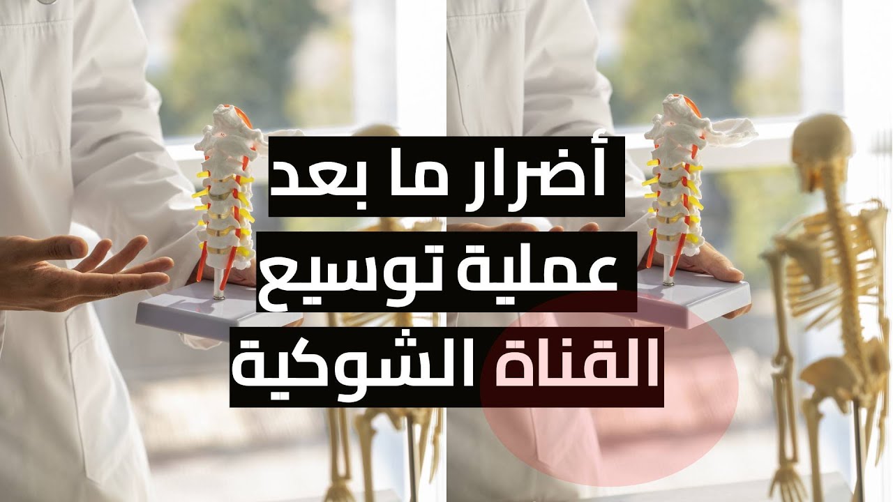 أضرار عملية توسيع القناة الشوكية ؟