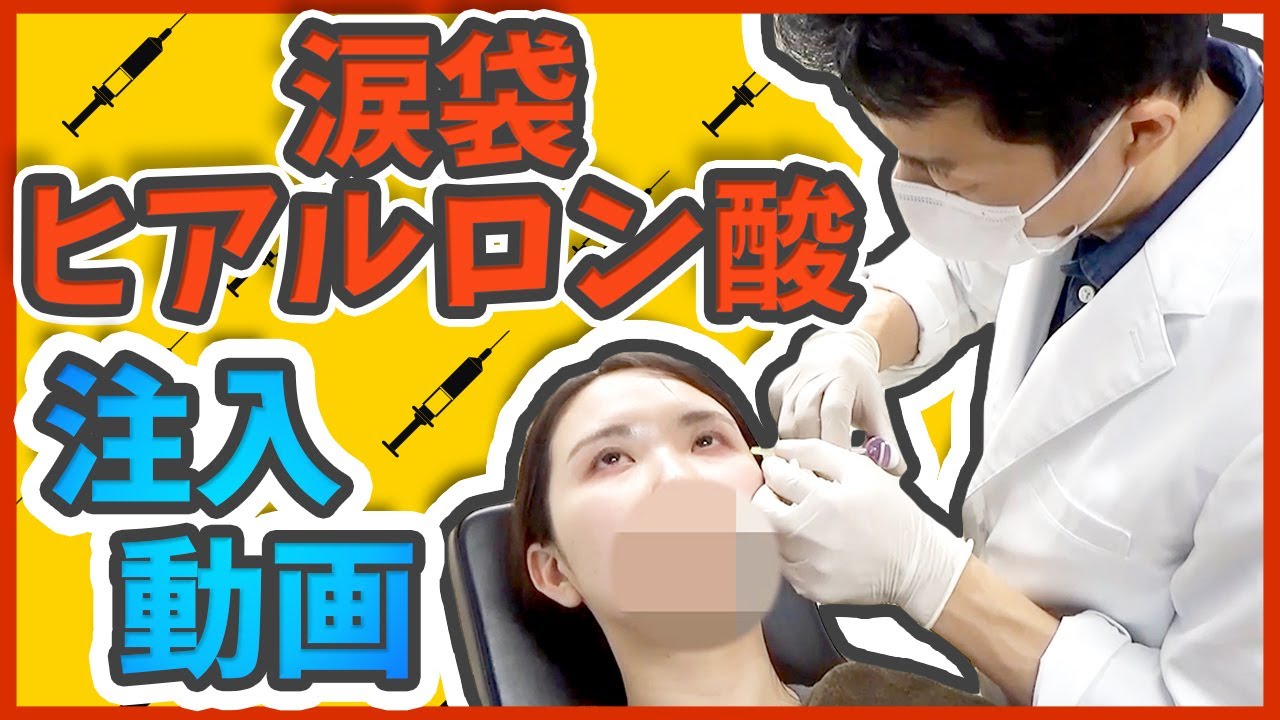 【涙袋形成】涙袋ヒアルロン酸注入の施術動画とビフォーアフターの症例写真