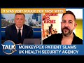 Monkeypox patient slams uk health security agency