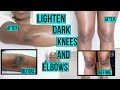 HOW TO LIGHTEN DARK KNEES AND ELBOWS FAST AND NATURALLY