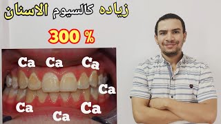 طرق زياده نسبه كالسيوم الاسنان بدون ادويه / اعراض نقص الكالسيوم في الاسنان