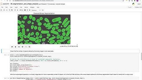 SimpleITK, A Simplified Path to Insight Tutorial: Segmentation