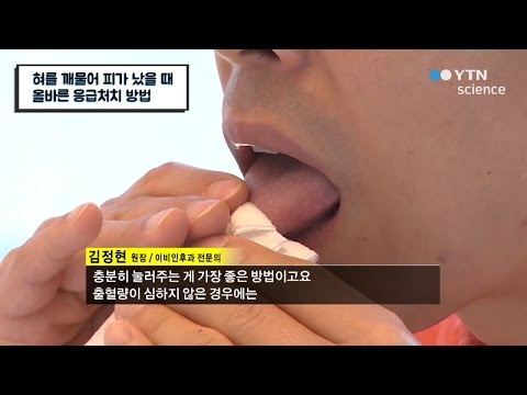 혀를 깨물어 피가 났을 때 올바른 응급처치 방법 / YTN 사이언스