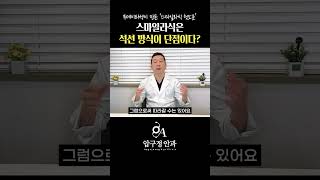 스마일라식은 석션 방식이 단점이다 #스마일라식 #투데이라섹