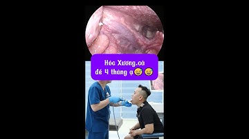 Hóc Xương.cá để 4 tháng ạ 耳かき - ASMR耳掃除 | Bác sĩ Hiệu Long Biên