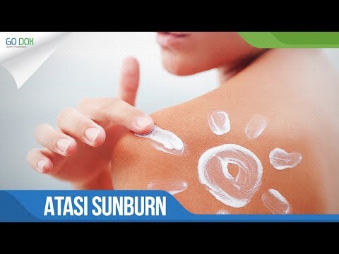Video: Cara Menghilangkan Lepuh Sunburn