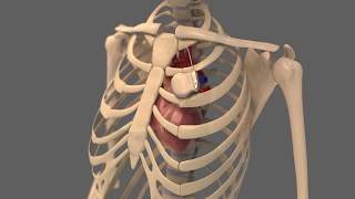 CRM Implantables With Bal Conn Electrical Contacts by BalSealEngineering 237 views 5 years ago 46 seconds