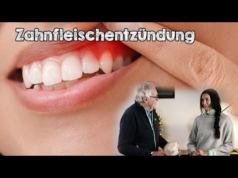 Video: 3 einfache Möglichkeiten, Gingivitis zu Hause zu behandeln