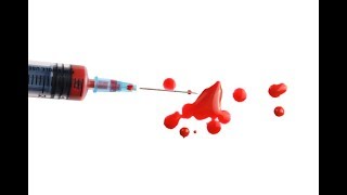 Failing Drug Test After Workplace Injury