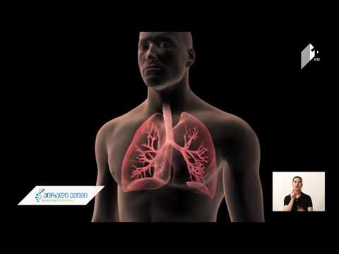 ტკბილეული, შესაძლოა, კიბოს მაპროვოცირებელი მიზეზი გახდეს - ტეხასის უნივერსიტეტის კვლევა