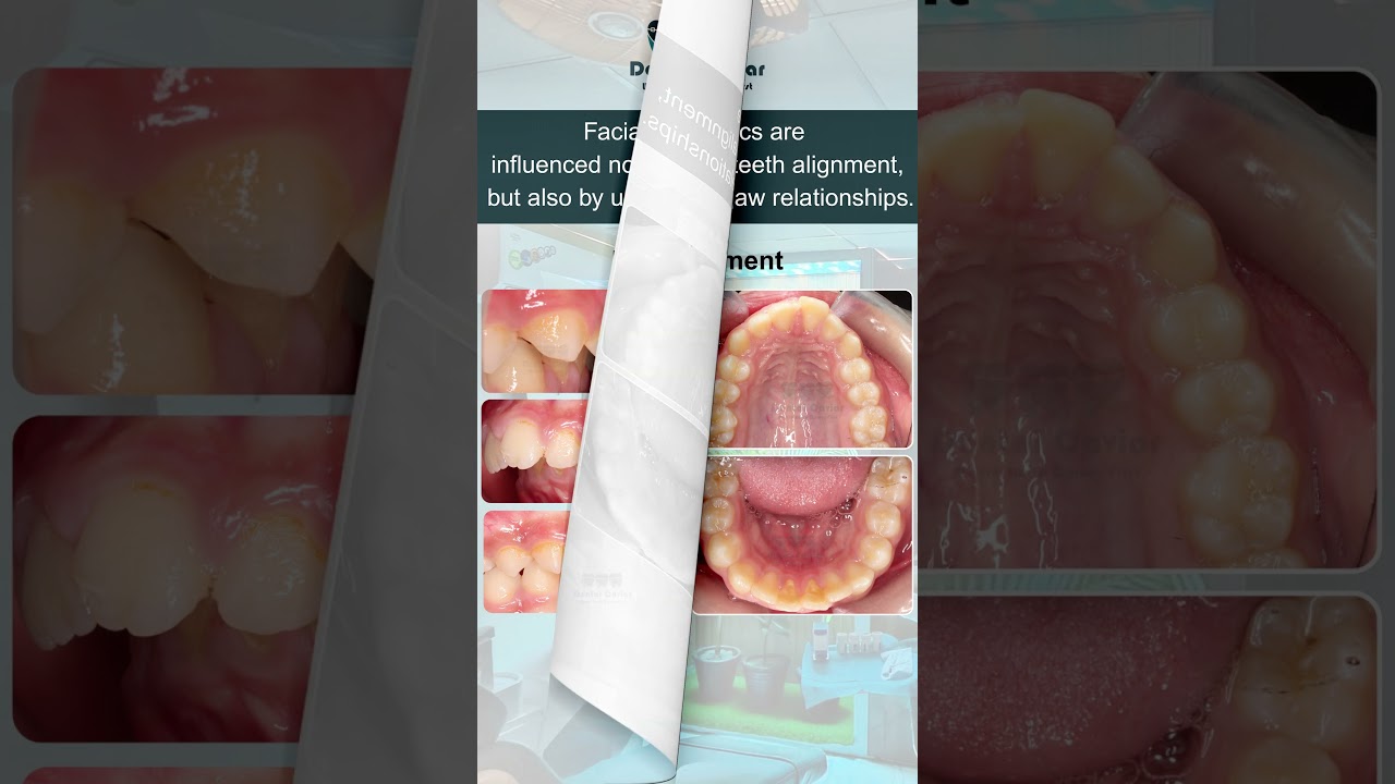 Best Dentist in Multan/ Best Orthodontist in Multan/ Best dental clinic in Multan