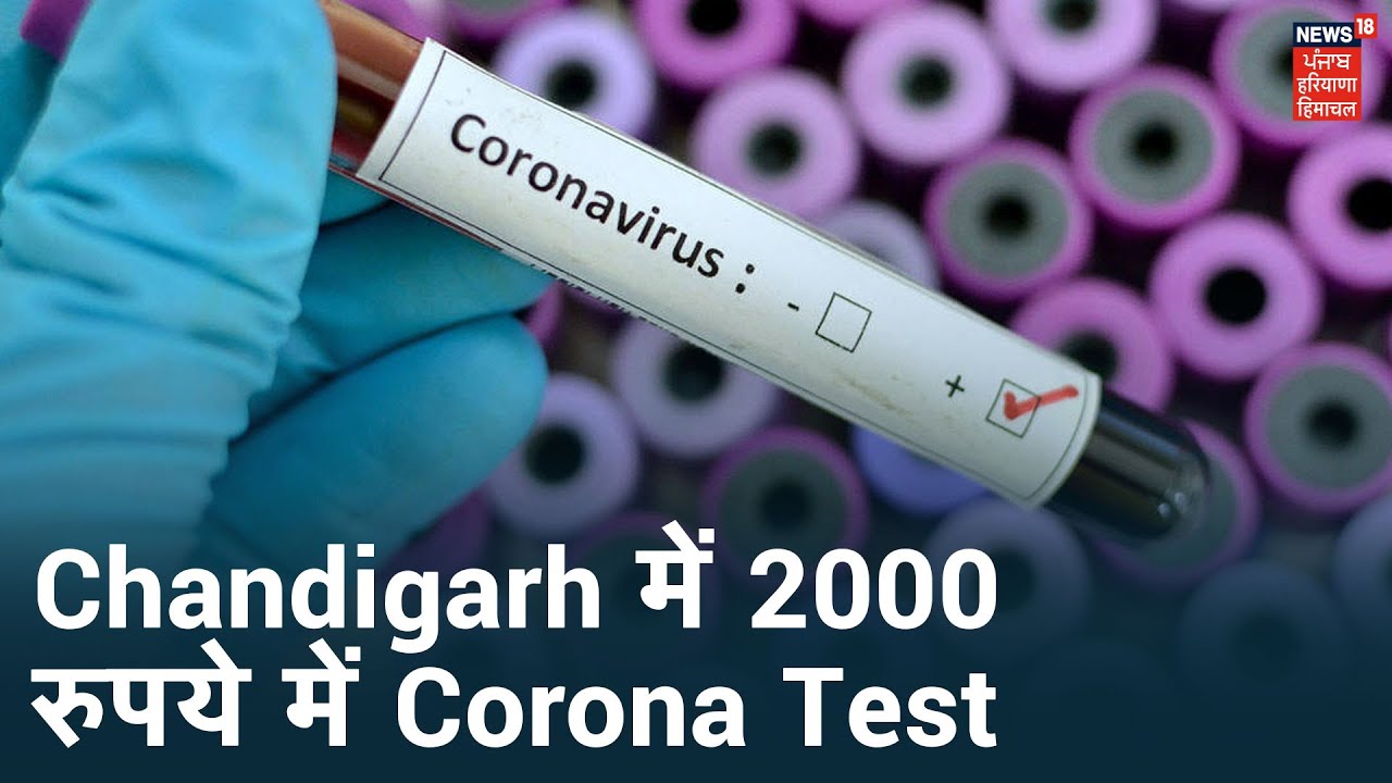 Chandigarh में 2000 रुपये में होगा Corona Test, Delhi और Haryana में भी टेस्ट हुआ सस्ता