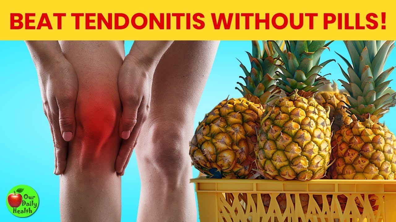 Tendonitis (Science-Backed): 10 Natural Ways to Support Tendon Health