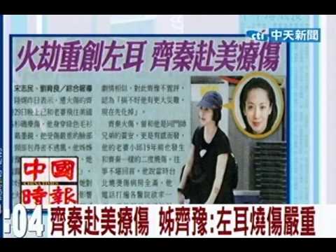 齊秦赴美療傷 姊齊豫：左耳燒傷嚴重