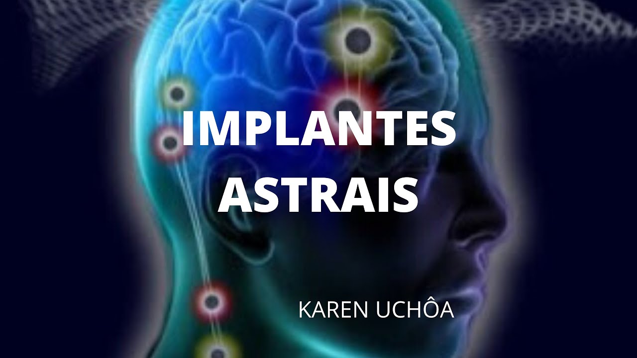 IMPLANTES ASTRAIS