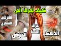 تشخيص أنواع آلام الظهر  كيف تفرق بين   شد عضلي   عرق النسا   دسك   انزلاق فقاري   الم الورك سمعها