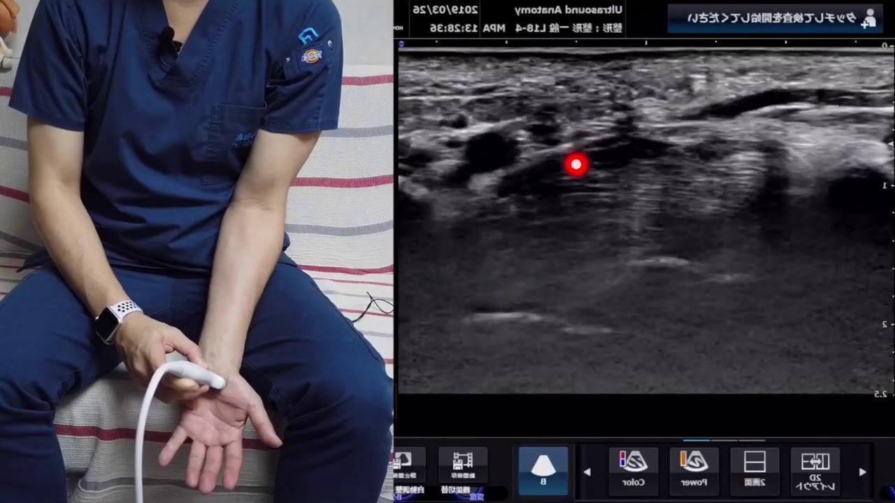 前腕の正中神経（手根管）