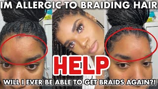 STORYTIME | I BECAME ALLERGIC TO BRAIDING HAIR OVERNIGHT | SEVERE ALLERGIC REACTION |GOLDENCHILDCHI