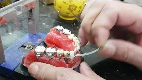 Dựng trục răng cối với khí cụ drphong