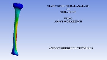 Tibia Bone | Static Structural Analysis I Deformation | Stress | Strain |ANSYS Workbench