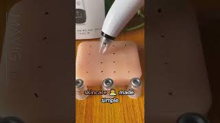 Product Link in Bio ( # 1694 ) 🛒Pure Skin Rechargeable Blackhead Remover Machine