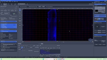 [Silence] Whole slide visualization disappears after new slide scan #zeiss #microscope