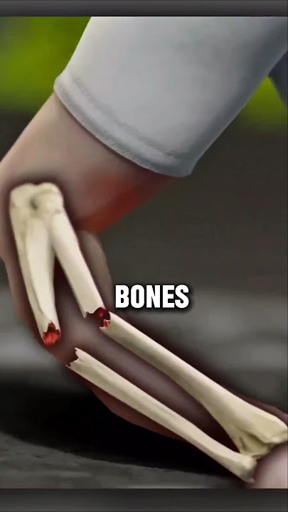 China’s 3-Minute Bone Glue
