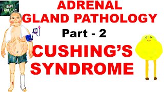 Adrenal Gland Pathology: Part -2. Hypercortisolism. CUSHINGS SYNDROME by ilovepathology 3,076 views 4 months ago 20 minutes