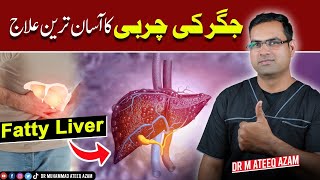 Jigar ki Charbi ka ilaj l Fatty liver treatment