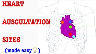 AUSCULTATION OF HEART SOUNDS AND THEIR ANATOMICAL LOCATION:  D&N Medical Series